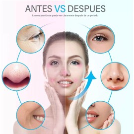 Apradas Tratamiento De Lifting Facial Exfoliante Ultrasónico Para La