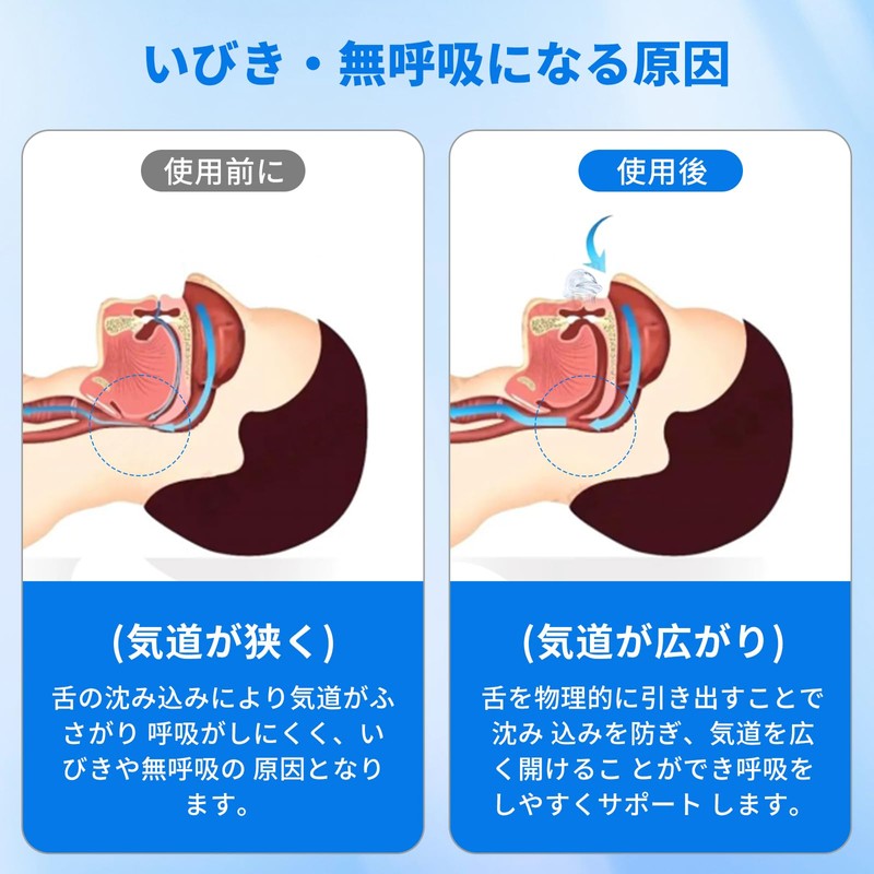 いびき防止グッズ いびきマウスピース いびき対策 安眠グッズ 舌安定用具 小型 軽量 無呼吸症候群グッズ 洗える 繰り返し使える