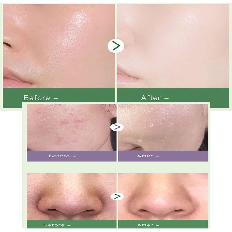 Bluemega Mascarilla de Arcilla de Artemisa, Adecuado para Pieles Sensibles