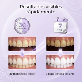 14pare Purple Teeth Whitening Strips Tiras Blanqueadoras Dientes Morado Tira Eficaz Eliminar Manchas Café Bebidas Deja Naturalmente Blancos Portátil