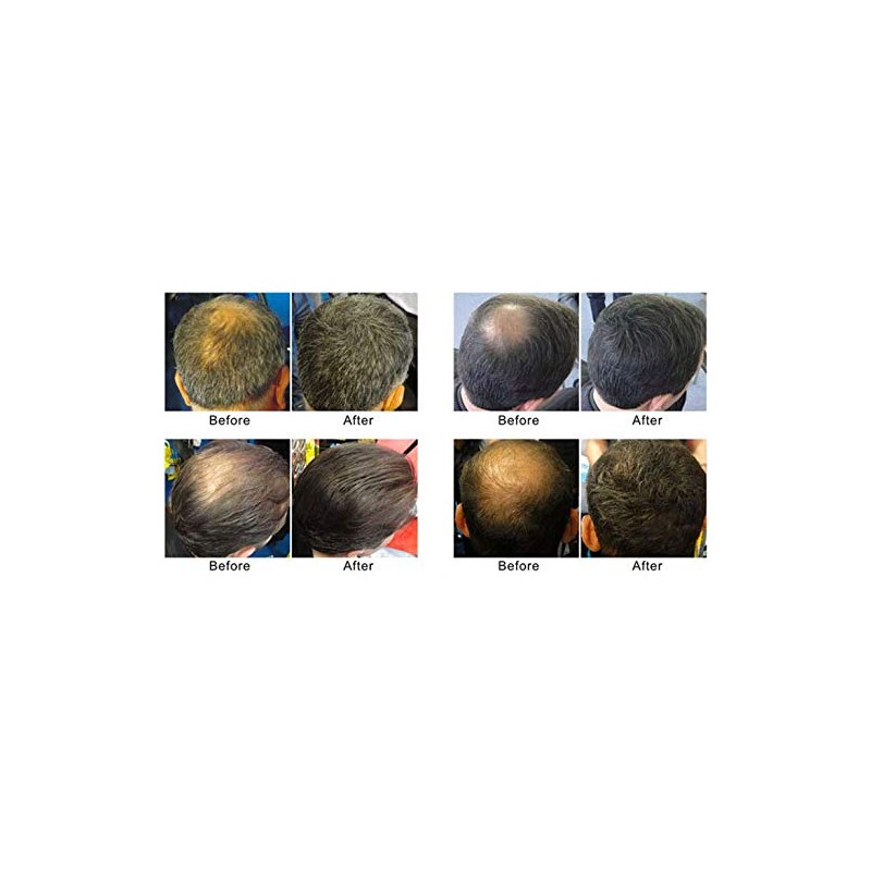 DEXE Hair Building Fiber, Conceals Thinning Hair (Dark Brown)