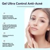 Crema Ácido Azelaico Crema Para El Acné Con Ácid 20g