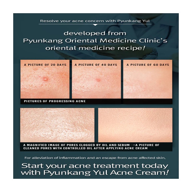 Pyunkang Yul [Pyunkang Yul]ACNE Cream 50ml