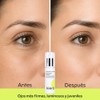 KIERO Crema Contorno de Ojos Retinal y Centella Asiática 25