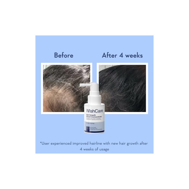 WishCare Hair Growth Serum with Rosemary, Redensyl, Anagain, Baicapil, Caffeine,