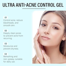 Gel Hidratante con Niacinamida para el Acné – Control de Grasa y Puntos Negros, Hidratación Ligera y Limpieza Profunda, Apto para Todo Tipo de Piel