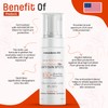Mesoderm RX Anti Sun Spots, 50ml