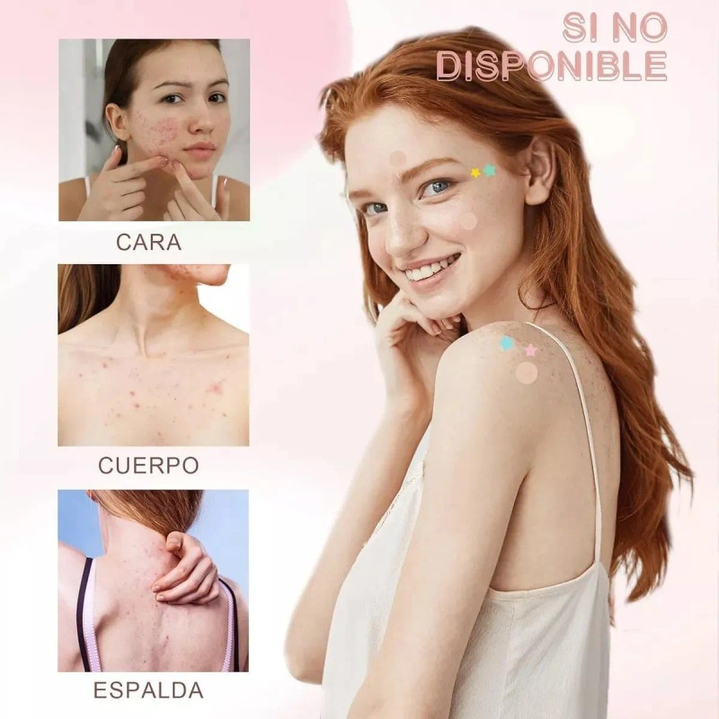 200pzs Mascarillas Estrella Acne