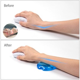 Blue Gel Mouse Wrist Rest–Clear Cute Fish Mouse Wrist Rest, Comfort & Support for Typing and Gaming (Fish, Blue)