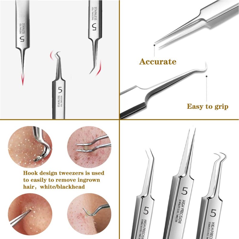 Professional Facial Blackhead Remover Tweezers,3Pcs Precision Pimple Popper Tool Kit
