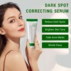 Dark Spot Correcting Glow Serum, Dark Spot Remover for Face