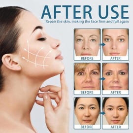 Anti-Aging Copper Peptide Serum,Copper Peptides Serum For Face,Hyaluronic Acid & Wrinkle Reduction,Fine Lines,Repair Damaged Skin,Promotes Radiant Skin,Hydrating S-erum Face For Women & Men,30ml