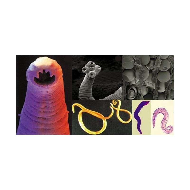 Kill Candida Capsules - Anti Parasite Cleanser 1485mg - Pectin