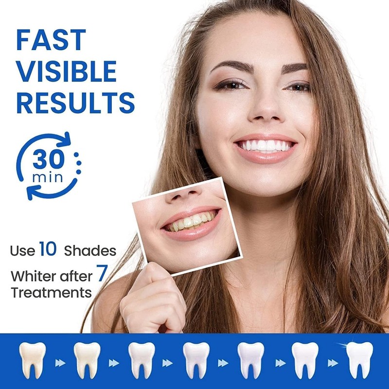 TeethBliss TeethBliss Teeth Whitening Strips: 28Pcs Whitening Strips, Enamel Safe,