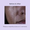 Isdinceutics Salicylic Renewal 30 ml – Renovación de la piel