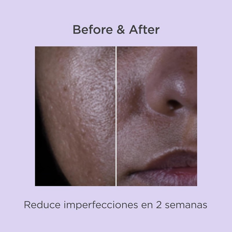 Isdinceutics Salicylic Renewal 30 ml – Renovación de la piel