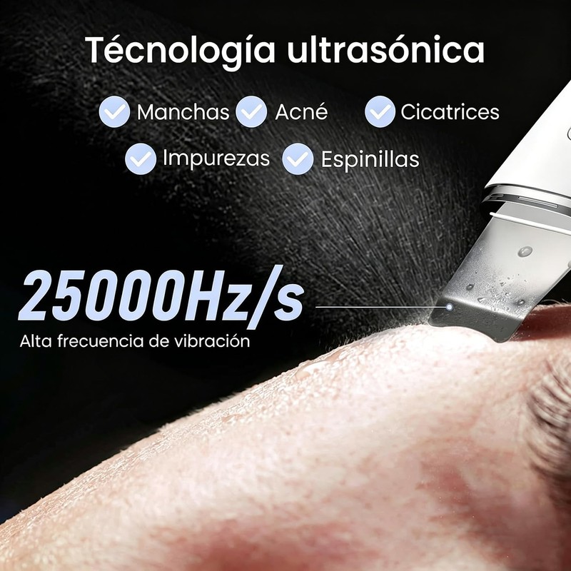 Peeling Ultrasónico Facial LOTOVERDE con 4 Modos y Limpieza Profunda