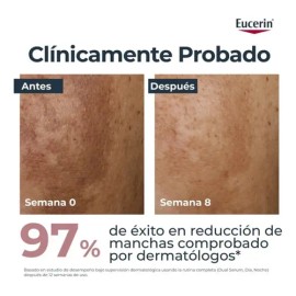 Eucerin Despigmentante Kit Crema Corporal 200ml  Serum Dual                                                                                           