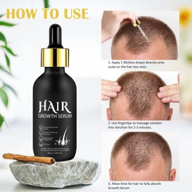 Hair Growth Serum, Organic 5% Hair Growth Oil Solution for External Use Hair Growth & Thickening Anti-Hair Loss Serum for Hair Loss Men (60 ml)