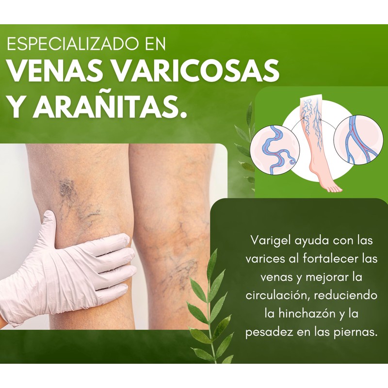 Varigel 475gr – Gel para piernas Cansadas e Hinchazón |