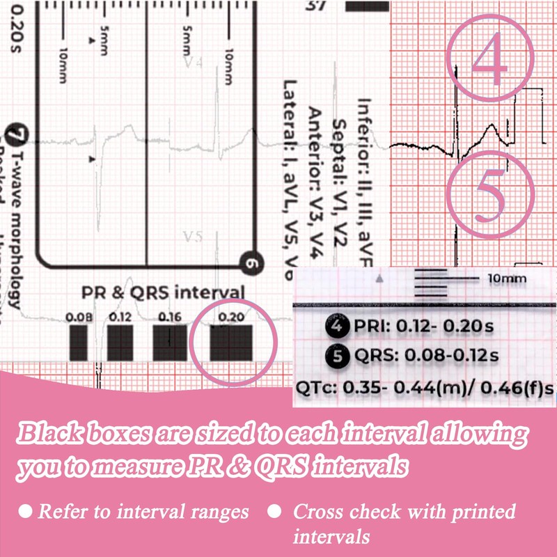 Ecg 7 Step Ruler, Ecg/Ekg 7 Step Ruler Card, Portable