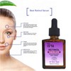 Retinol Serum for Face, Neck, Wrinkles - Resurfacing, High Strenthg