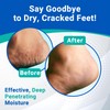 Dermal Therapy Heel Care Cream - Moisturizing Treatment that Repairs