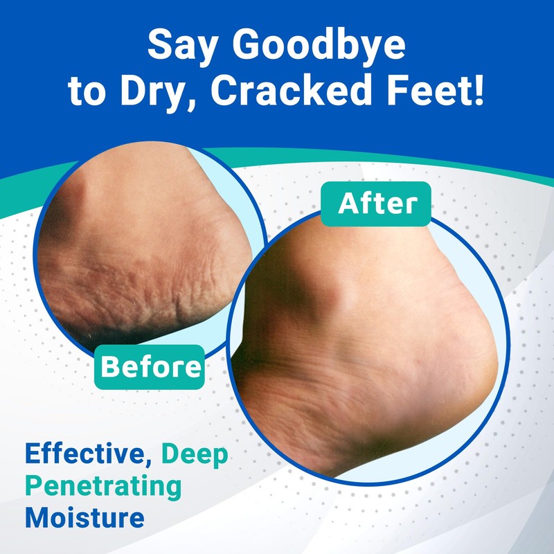 Dermal Therapy Heel Care Cream - Moisturizing Treatment that Repairs