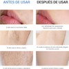 Depilación Láser IPL con Enfriamiento y 9 Niveles, 999,999 Destellos