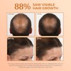 BosleyMD BosRevive KIT for Visible Hair Thinning (Color Safe), Starter