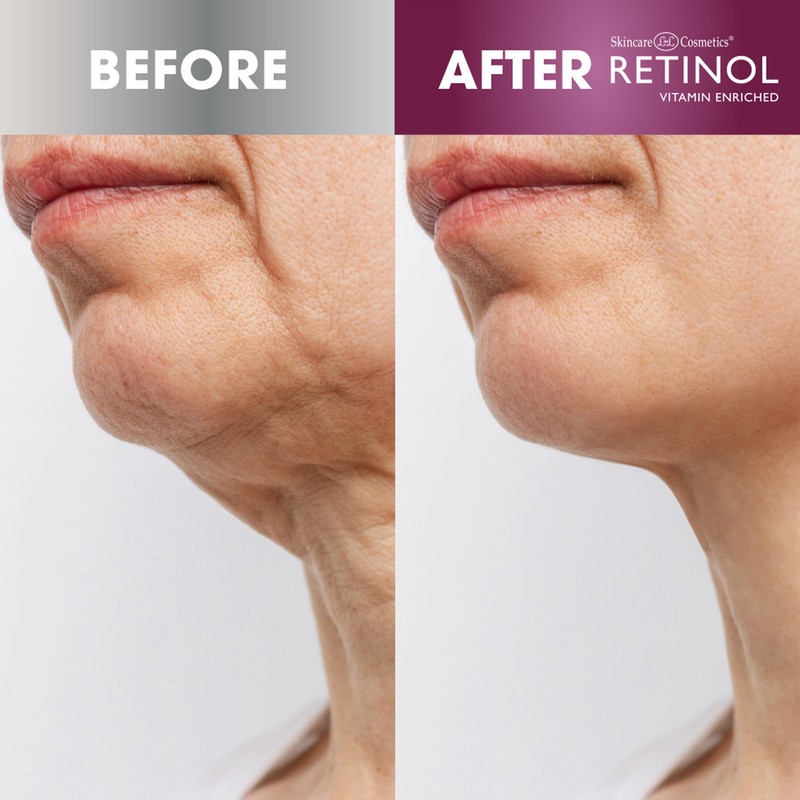 Retinol Anti-Aging Neck Firmin Cream - Tightens, and Smooth Neck