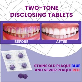 50 Tablets Dental Disclosing Tablets for Kids and Adults - Individually Wrapped Plaque Disclosing Solution - Safe & Effective Two-Tone Dental Cleaning