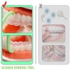 Invisible Braces Remover, Pack of 30 Aligner Removal Tool, Aligner