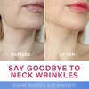 Neck Wrinkle Patches, High Elastic Neck Strips, Instant Tape for