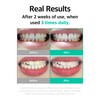 Live Orals Whitening Toothpaste 80g - Fluoride-Free Stain Removal, Strengthens