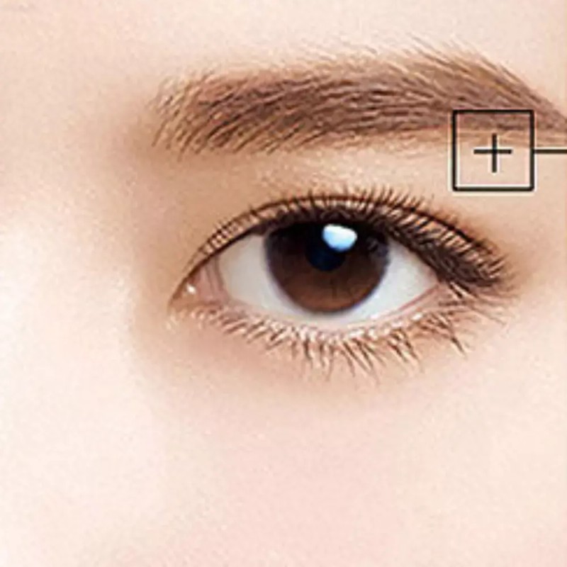 눈꺼풀처짐 눈꼬리올리기 눈꺼풀처짐리프팅 짝눈 교정 [필수/화이트] Eyelid Droop Lifting, Eyelash