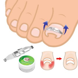 1pc Silver Ingrown Toenail Correction 17 to 22mm Adjustable Stainless Steel Toenail Corrector Pedicure Paronychia Correction Tool Nail Tools