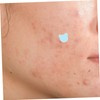 Baluue 5 Sheets Facial Mole Patches for Stickers Pimple Patches