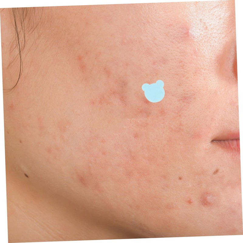 Baluue 5 Sheets Facial Mole Patches for Stickers Pimple Patches