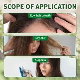 Aceite de Romero para Cuidado de la piel Hair, Aceite Esencial Romero Crecimiento del Cabello Aromaterapia Rosemary Oil Uso Difusore, Humidificador, Pieles Masajes o Cabello - 30 ml