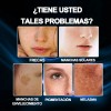 Serum Facial Whitening Y Freckle Eliminar Antiarrugas 40ml