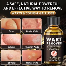 Wart Remover,Skin Tag Removal Kit Fast-Acting Skin Tag & Wart Remover for Feet & Hands,Wart Removal for Plantar Wart and Common Wart,Safe & Natural (30ML)