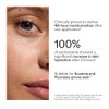 The Inkey List Urea 10% Moisturiser 50ml, Supersolutions, Targets Severe