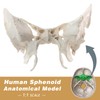 Benilev Human Sphenoid Anatomical Model, Life Size, Presenting Complete Cracks,