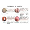Pomada Nopsor Aux En El Tx De Psoriasis