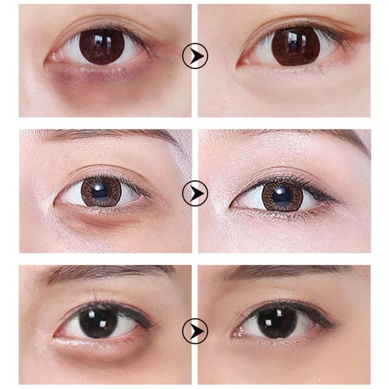 Universo en Linea Parches Para Ojos Lanbena Vitamina C Antiarrugas