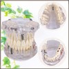 Dental Model, Dental Model, Implant Bridge Dental Dental Research Description