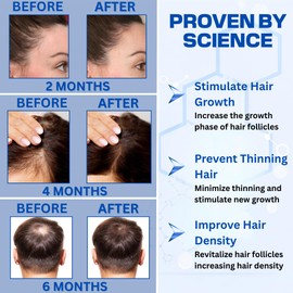 Copper Peptide Hair Serum – 10% GHK-Cu + 5% AHK-Cu Peptides for Hair Growth & Scalp Health – Advanced Regrowth Treatment for Thicker, Fuller Hair