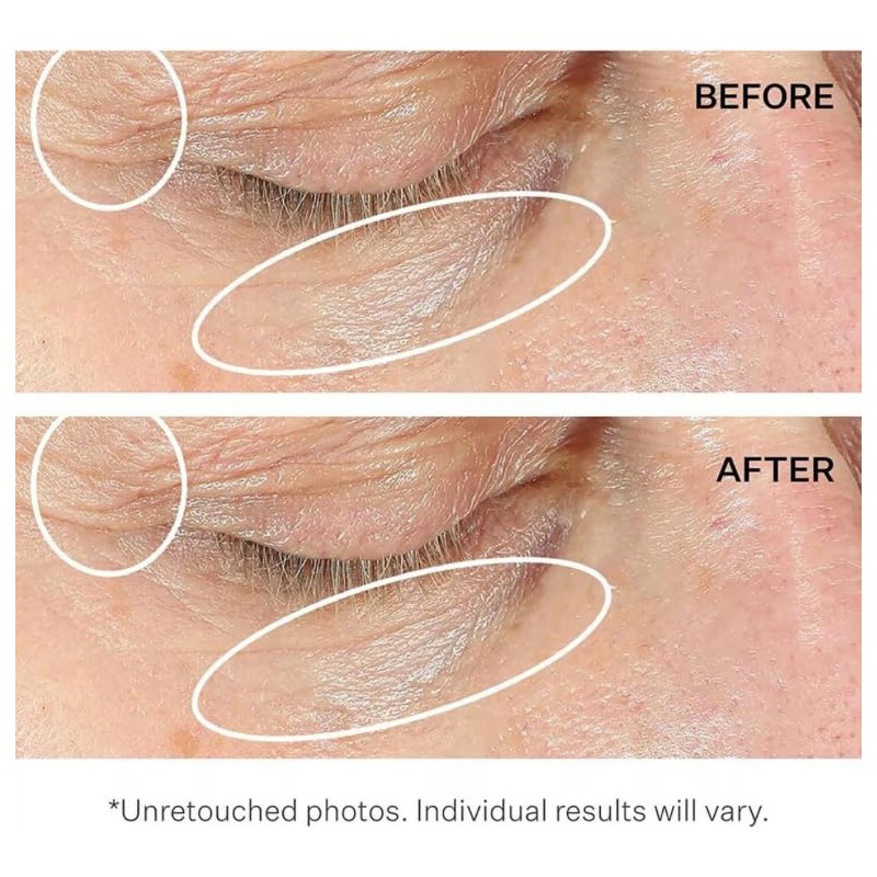 strivectin Crema antiarrugas1 Sd Advanced Plus 2 Pack De 47ml