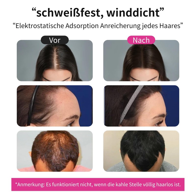 SEVICH Sevich Streuhaar - 100g Nachfllpackung Fr Haarausfall Oder Dnner
